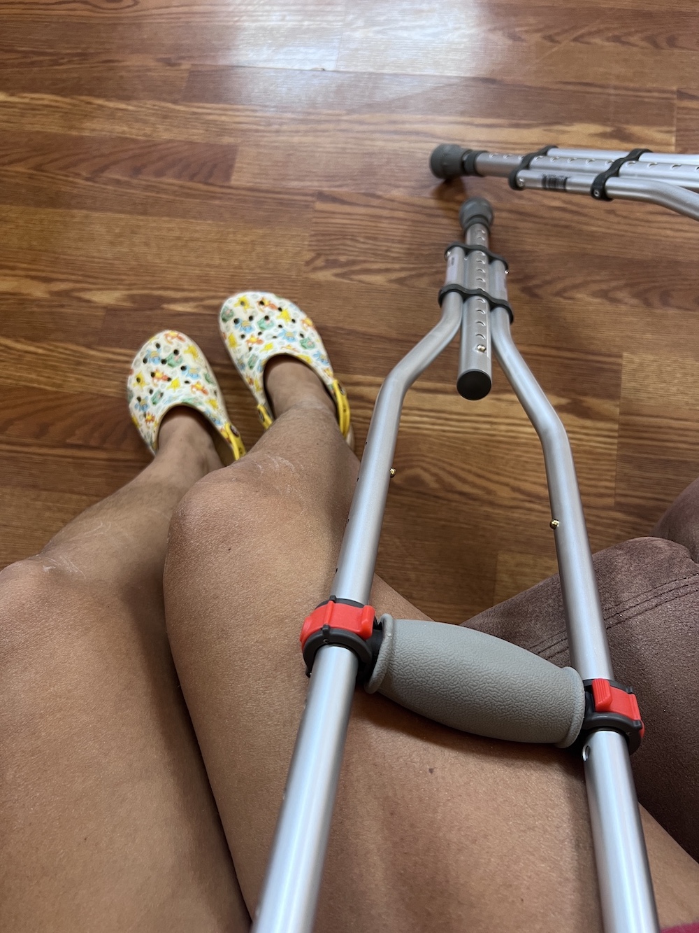 legs next to crutches